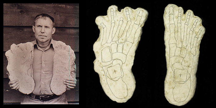 Rene Dahinden Cripple foot cast